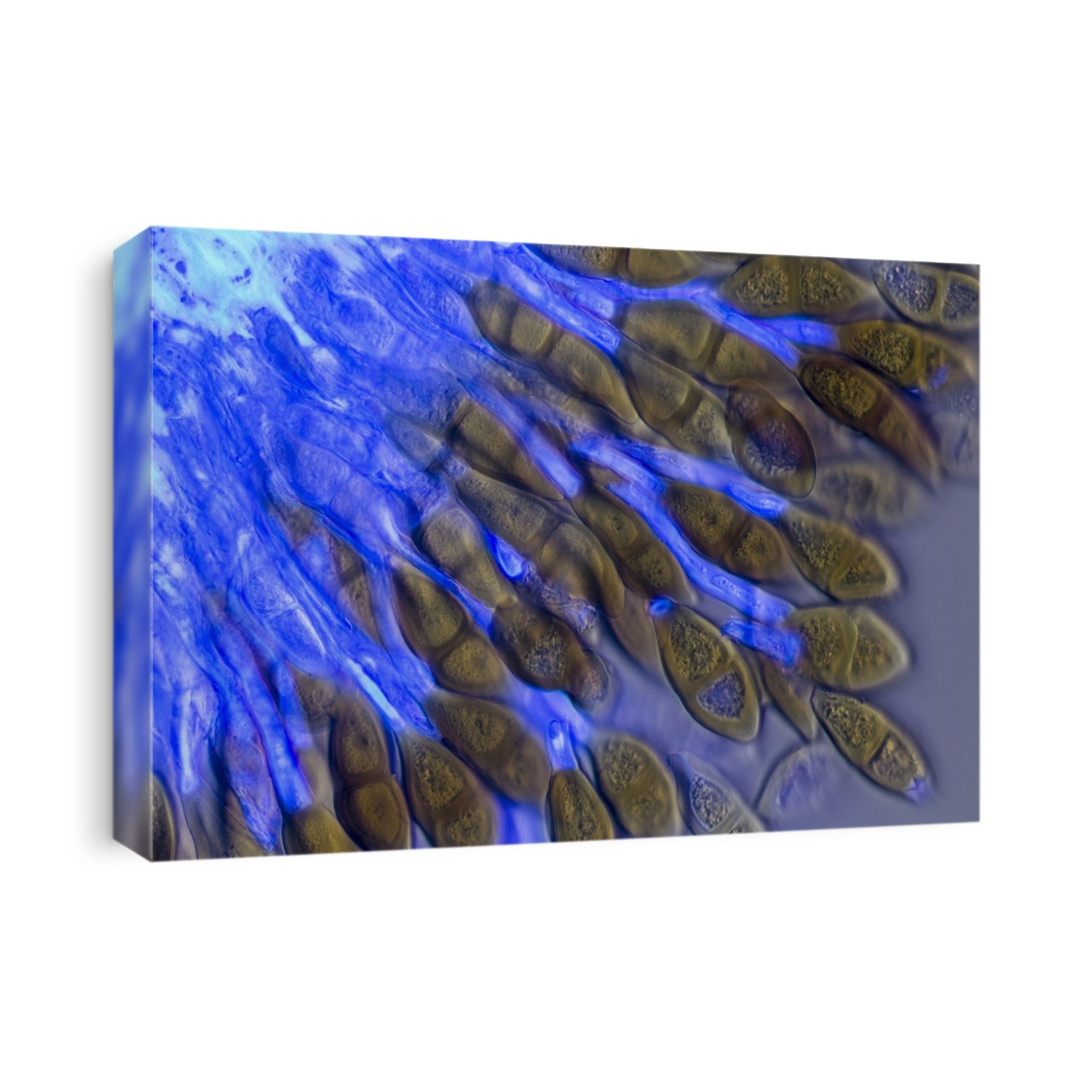 Light micrograph of Teliospores of Hollyhock rust, Puccinia malvacearum, fungus mycelium stained with Calcofluor white stain, UV Epifluorescence, fungus mycelium shows blue fluorescence. Magnification 360x when printed at 10 centimetres wide.