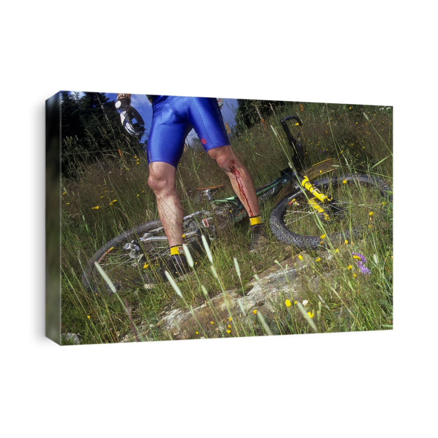 Injured mountain bicycllist.